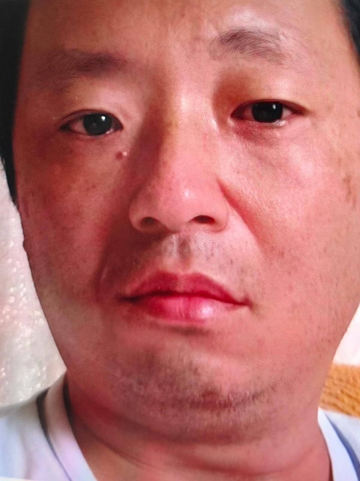 ROBERTO YUKIO INAY